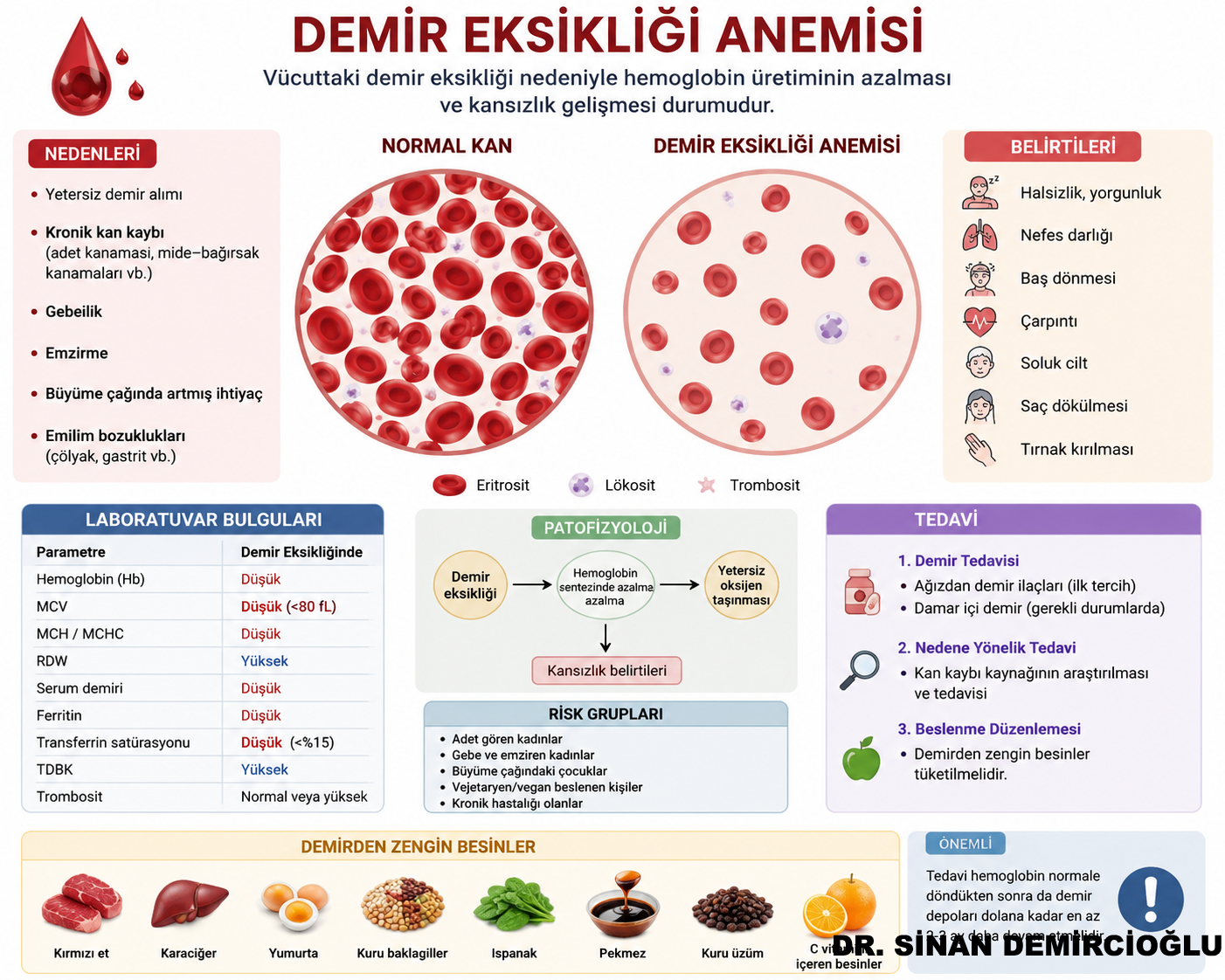 sinan demircioğlu Demir Eksikliği Anemisi Nedir?